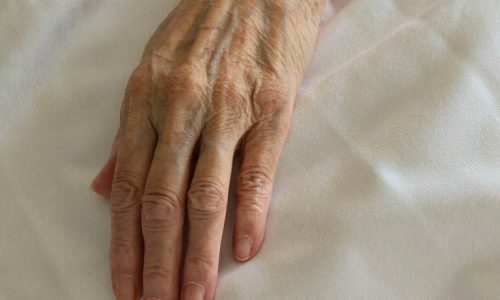 Older person's hand lying on bed sheet